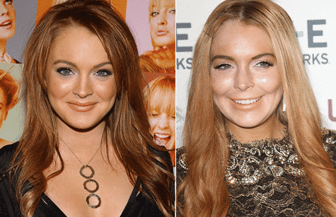 Lindsay Lohan avant et après chirurgie esthétique